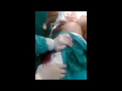 Doctor Literally Hammers out Board Stuck inside Man Like Paul Bunyan