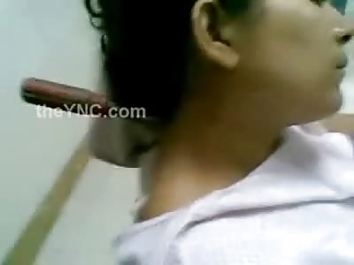 Different Footage of the Woman with a Screwdriver Stuck in her Head