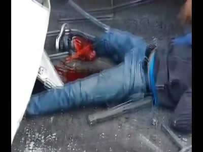 Family caught in Horrific Accident..Kid has his Leg Bone through his Leg