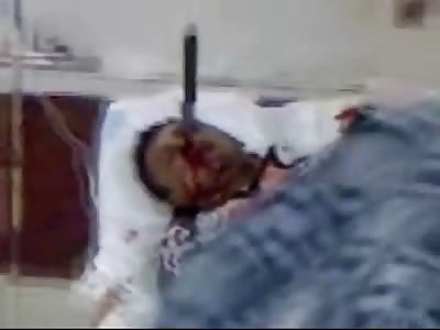 Amazing Video shows Man with Knife Stuck in his Eye Thrashing in the Hospital Bed