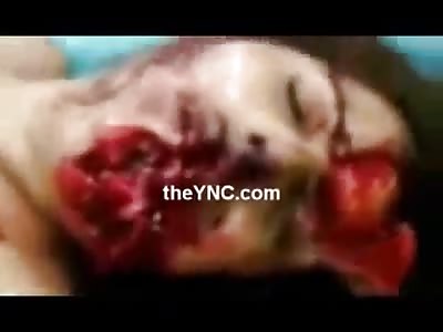 Failed Suicide Attempt is Horrible .. They Thought Life used to be Bad