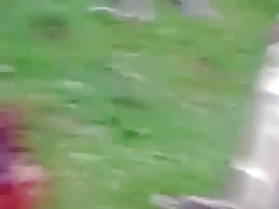 Boy was Bit by a Dog and Scalped to the Bone of his Skull..(Uncensored)