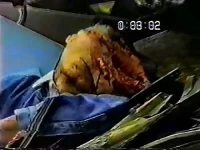 Vintage Gore Shows Old man in Accident With Head Caved in and Brains o the Road