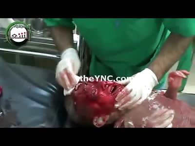 Hard to Watch Video shows Young Boy looking to be Praying as Doctors try to Help Him (Horrific Head Wounds) 