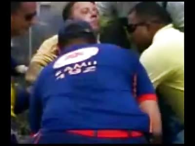 Electrical Power Lines Worker Burned so Badly you can See his Wrist Bones