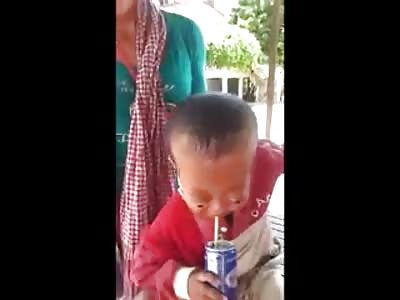 Poor Kid with Bugged out Eyes