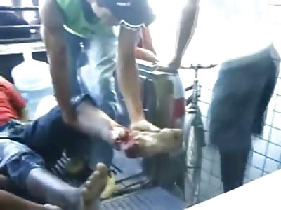 Camera guy likes to Get Up Close and Personal on Guy with Compound Ankle Fracture