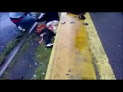 Woman Struck by Train Still Alive Twisted up Talking Calmly to a Man