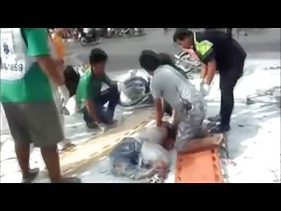 Boys Dome is Cracked Like an Egg Shell