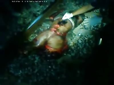 What Remains of a Woman with Tan Lines after Being Demolished by a Train