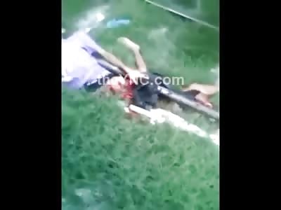 Boy With his Legs Ripped off by a Train Still Alive and Talking