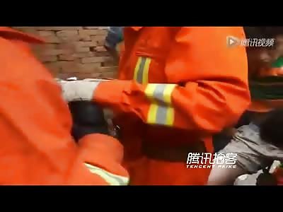 Poor Man with a Metal Rebar Stuck Through his Crotch