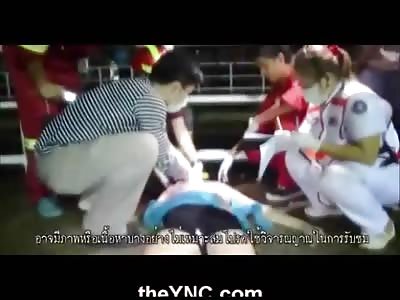 Woman with Femur Exposed is to Far Gone To Save