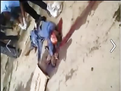 Man is Scalped after Horrific Accident