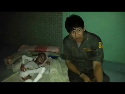Very Sad and Shocking Video show Emaciated Malnourished Boy Badly Burned Dying from an Infection 