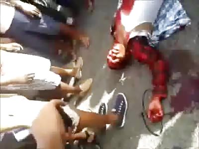 Total Agony .. Bleeding Man Gets Hoisted into Pickup Truck