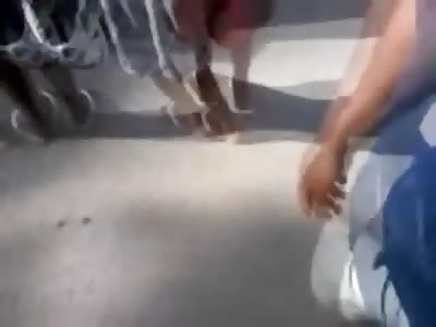 Man Twisted after Accident with His Arm Ripped Off