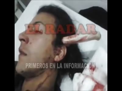 Knife Stuck through your Head and Still Able to Speak to the Camera