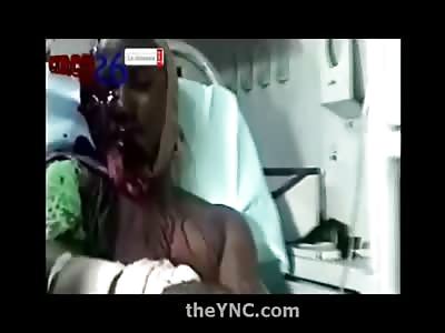 Man Wounded by Machete to the Face sits Calmly and Stares at the Camera