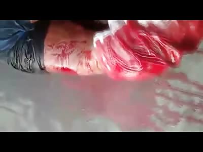 The Agonizing Face of a Thief that's About to Bleed out on the Street