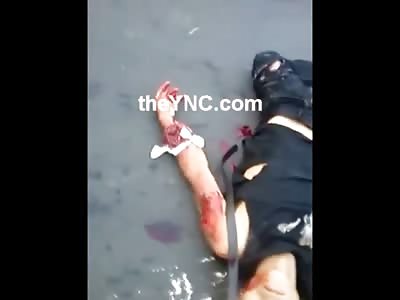 Two Riders in Agony One with a Mohawks Leg Ripped Wide Open