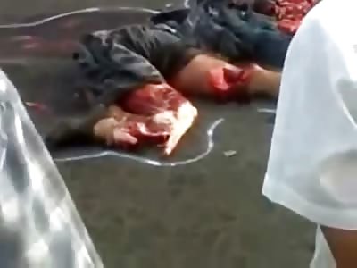 Mans Mutilated Body From Accident Required Chalk Lines Around Every Piece 