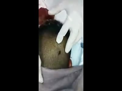 Short Aftermath Video of Man with Rifle to the Head Shot 