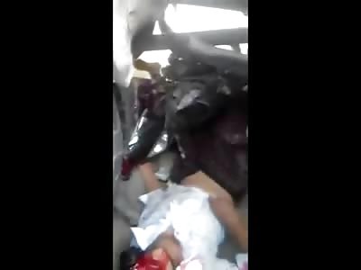 Good People Work Together to Lift Truck off of Schoolgirl's Severed Leg (Watch Full Video) 