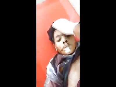 Poor Kid Speaks to Camera with his Stomach Blown Apart and Exposed