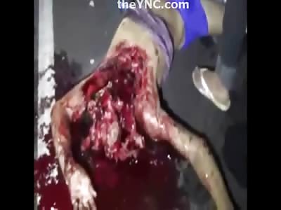 Motorcyclist Partially Decapitated in Gruesome Accident 