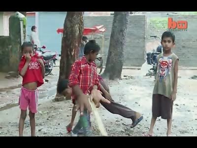 Poor Kid with Mystery Mutation Has his Hands Twice the Size of his Head