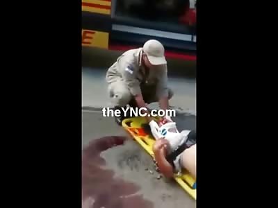 Woman Screaming at the Top of her Lungs with a Neck Injury While her Calm Boyfriend Sits there with his Leg Nearly Ripped Off