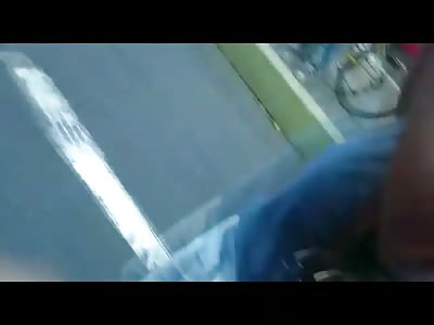 Man in Brand New Clean White Pants Gets them Ruined when his Leg is Ripped Apart