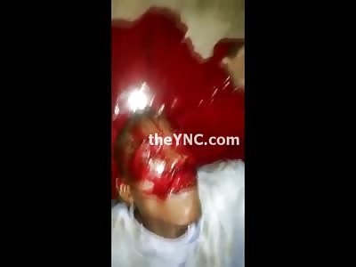 Machete Murder Victim lies in a Pool of his Own Blood in Bloody Murder Scene