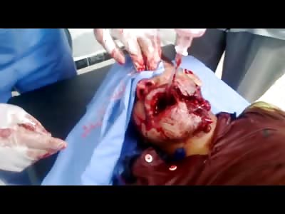 Shrapnel Fucks this Guys Mouth all Up