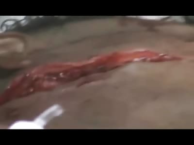 Mans Face Hacked up by Machete Blows