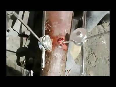 Maggots Set up a New Colony in Homeless Mans Leg