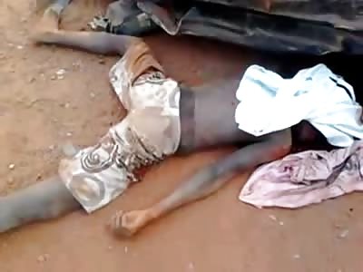 FACE OFF: Mans Face is Ripped Right off From Horrific Accident