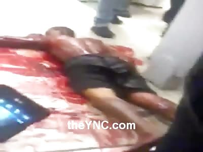 Stabbed Man in Agony Literally Swimming in his Own Blood