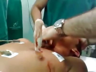 New Video of Man with Huge Knife Stuck Inches Away from His Heart