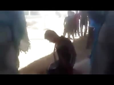 HARD HEAD: Man Takes Several Bullets from a Pistol after First Head Shot Doesn't Kill