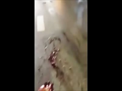 Couple killed in accident (woman ripped apart, eye popped)