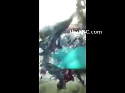 Young Man Trying to Throw a Bomb when it Exploded in his Face....Gurgling Blood 