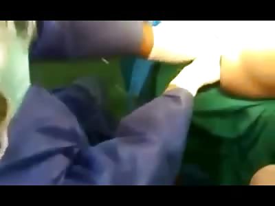 In this WTMF Video a Man Has Hairspray Can Removed from his Asshole