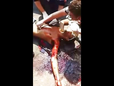 Man Takes his Final Gasp of Air 