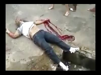 Camera Operator gets Up Close and Sideways to Man with a Gruesome Head Wound 