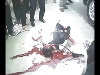 Gruesome Shock Video shows Schoolboy with a Reaping Hook through his Skull (Volume Warning) 