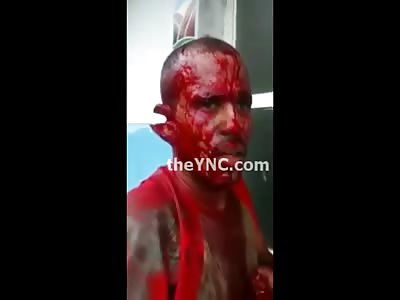 Man Holding his Own Dangling Hand after Gruesome Machete Attack in his Own Home  (Watch Full Video)