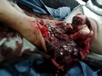 Take 4 Aspirin and Walk it Off