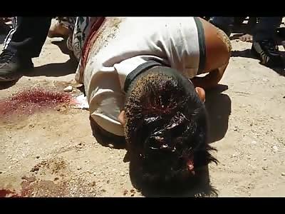 Man Dies Slowly Foaming at the Mouth